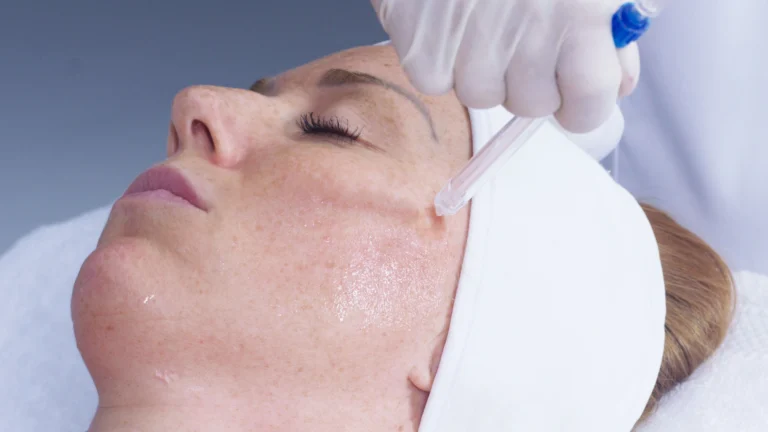 JetPeel vs Hydralift : quelle technologie choisir pour sublimer votre peau ?