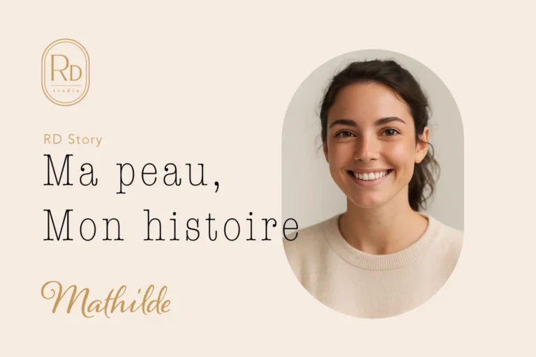 RD Story – Mathilde se confie sur son retour d’expériences d’épilation laser