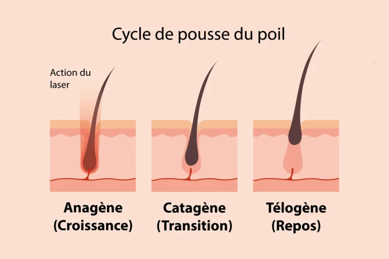 Comprendre le poil et les cycles pour mieux agir avec le laser